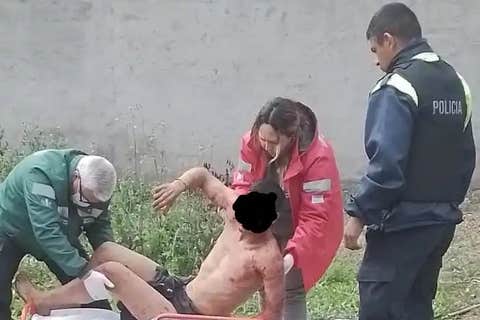 Revelan el nuevo parte médico del joven que fue atacado por una jauría de perros en Yerba Buena
