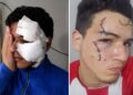 Delincuentes con tobillera electrónica hirieron a un joven durante un violento intento de robo en Tafí Viejo