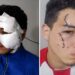 Delincuentes con tobillera electrónica hirieron a un joven durante un violento intento de robo en Tafí Viejo