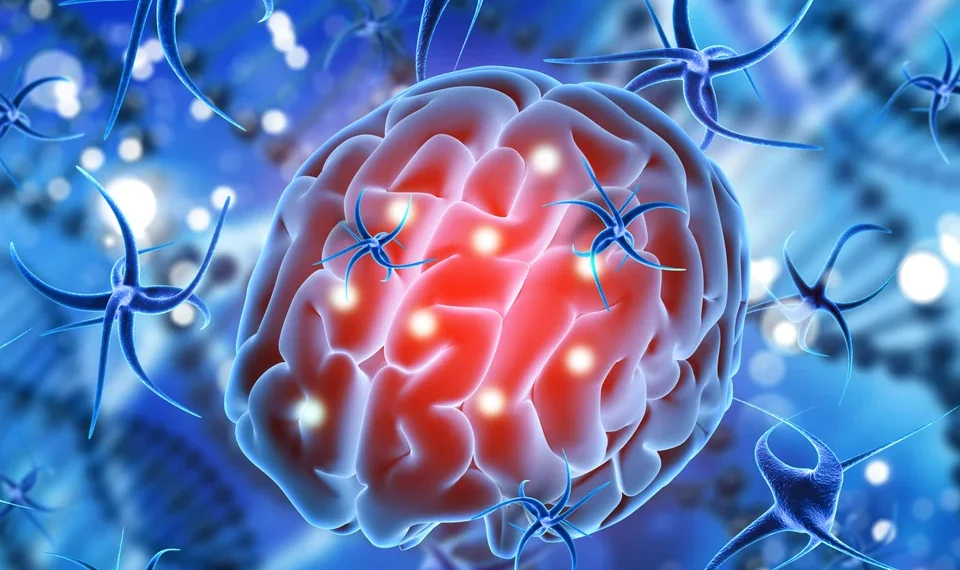 Llega a Argentina una terapia que es la primera innovación para gliomas en más de 20 años